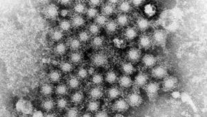 Parents told to check childrens handwashing after hepatitis A outbreak