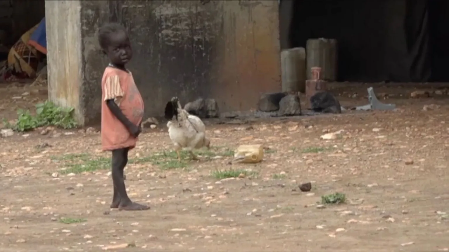 A hungry child standing int he field.